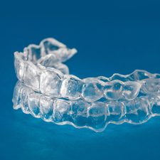 How Does Invisalign Work?