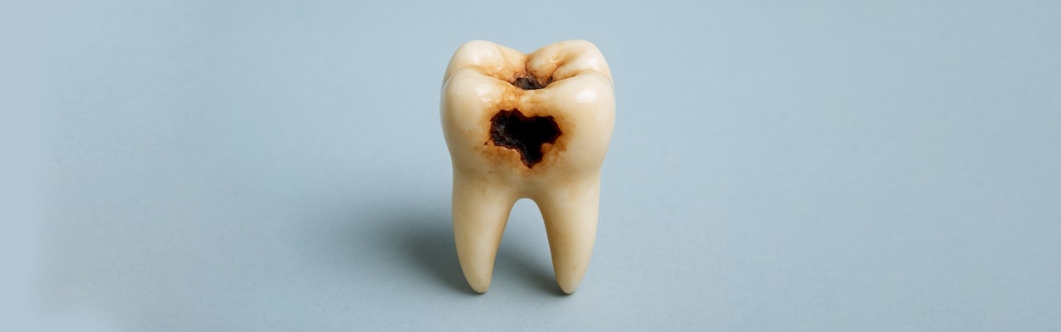 How To Know If a Tooth Infection Is Spreading