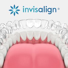 Get a Straighter Smile Without Sacrificing Comfort with Invisalign